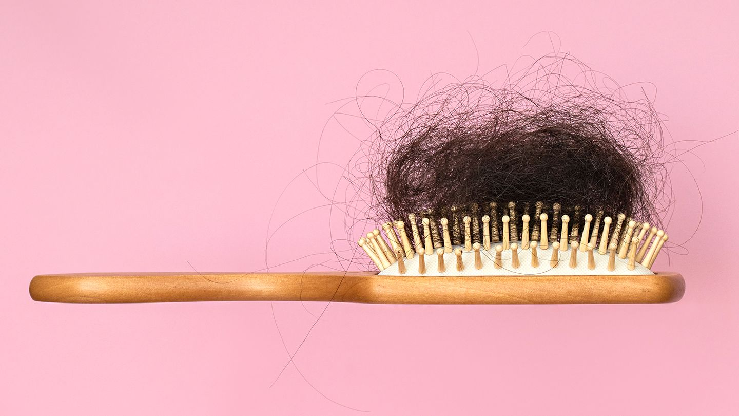 What is Female Pattern Hair Loss?
